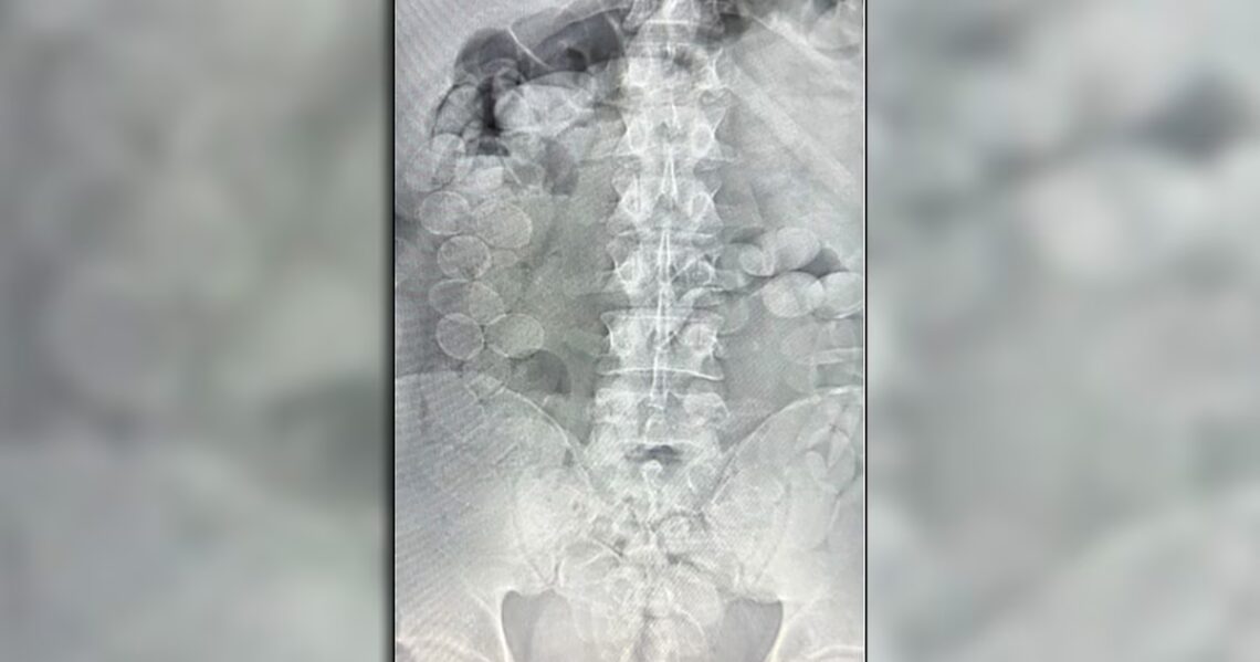 Viajaban en un micro con cápsulas de cocaína en su cuerpo y los descubrieron: los condenaron a 4 años de prisiónSe trata de dos ciudadanos bolivianos que fueron detenidos en diciembre pasado, tras un operativo de Gendarmería en Santa Fe. Trasladaban más de un kilo de cocaína cada uno en su organismo